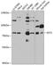 Exostosin Glycosyltransferase 2 antibody, GTX64836, GeneTex, Western Blot image 