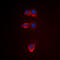 BCL2 antibody, LS-C358426, Lifespan Biosciences, Immunofluorescence image 