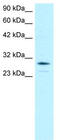 Homeobox protein OTX2 antibody, TA330538, Origene, Western Blot image 