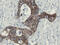 Src Like Adaptor 2 antibody, M06566-1, Boster Biological Technology, Immunohistochemistry paraffin image 