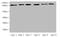 Minichromosome Maintenance Complex Component 3 antibody, A68307-100, Epigentek, Western Blot image 