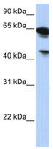 Abhydrolase Domain Containing 16A antibody, TA338461, Origene, Western Blot image 