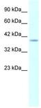H6 Family Homeobox 1 antibody, GTX48950, GeneTex, Western Blot image 