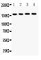 ATP Binding Cassette Subfamily B Member 4 antibody, PA5-78692, Invitrogen Antibodies, Western Blot image 