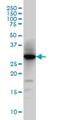 Histamine N-Methyltransferase antibody, H00003176-M03, Novus Biologicals, Western Blot image 