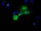 Cytoplasmic dynein 1 light intermediate chain 1 antibody, GTX84597, GeneTex, Immunocytochemistry image 