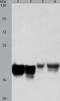 AUP1 Lipid Droplet Regulating VLDL Assembly Factor antibody, TA321998, Origene, Western Blot image 