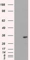 DNA Fragmentation Factor Subunit Alpha antibody, CF500063, Origene, Western Blot image 