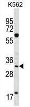 Ficolin 3 antibody, AP51643PU-N, Origene, Western Blot image 