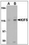 KIF5A antibody, AP08937PU-N, Origene, Western Blot image 