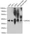 Capping Actin Protein Of Muscle Z-Line Subunit Alpha 2 antibody, A09995, Boster Biological Technology, Western Blot image 