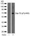 Zeta Chain Of T Cell Receptor Associated Protein Kinase 70 antibody, orb14873, Biorbyt, Immunohistochemistry paraffin image 