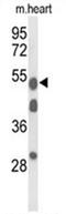 Alpha-1-B Glycoprotein antibody, AP50004PU-N, Origene, Western Blot image 