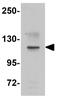 Nucleotide Binding Oligomerization Domain Containing 1 antibody, GTX31810, GeneTex, Western Blot image 