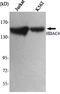 Histone Deacetylase 4 antibody, M00971-1, Boster Biological Technology, Western Blot image 