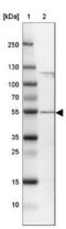 Coiled-Coil Domain Containing 14 antibody, NBP2-33998, Novus Biologicals, Western Blot image 