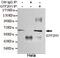 General Transcription Factor IIH Subunit 1 antibody, GTX49172, GeneTex, Immunoprecipitation image 