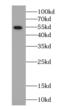 Arylsulfatase K antibody, FNab00613, FineTest, Western Blot image 