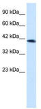 Zinc Finger Protein 670 antibody, TA341431, Origene, Western Blot image 