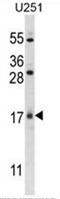 SUZ RNA Binding Domain Containing 1 antibody, AP50534PU-N, Origene, Western Blot image 