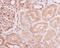  antibody, M00945, Boster Biological Technology, Immunohistochemistry paraffin image 