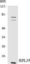 Ribosomal Protein L35 antibody, LS-B14695, Lifespan Biosciences, Western Blot image 
