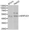 Homocysteine Inducible ER Protein With Ubiquitin Like Domain 1 antibody, A04908, Boster Biological Technology, Western Blot image 