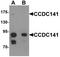 Coiled-Coil Domain Containing 141 antibody, TA320162, Origene, Western Blot image 