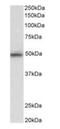 Mitogen-Activated Protein Kinase 9 antibody, orb12370, Biorbyt, Western Blot image 