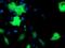 Epsin 2 antibody, MA5-25871, Invitrogen Antibodies, Immunocytochemistry image 