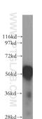 Carbohydrate Sulfotransferase 10 antibody, 12013-1-AP, Proteintech Group, Western Blot image 