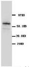 Solute Carrier Family 1 Member 3 antibody, PA1038, Boster Biological Technology, Western Blot image 