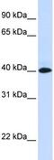 V-set and immunoglobulin domain-containing protein 8 antibody, ab83852, Abcam, Western Blot image 