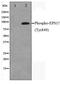 Epidermal Growth Factor Receptor Pathway Substrate 15 antibody, TA348437, Origene, Western Blot image 