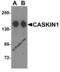 CASK Interacting Protein 1 antibody, 6991, ProSci Inc, Western Blot image 