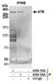 Serine-protein kinase ATM antibody, A300-135A, Bethyl Labs, Immunoprecipitation image 
