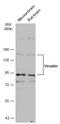 Vezatin, Adherens Junctions Transmembrane Protein antibody, GTX116240, GeneTex, Western Blot image 