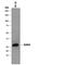 Killer Cell Lectin Like Receptor G1 antibody, MAB70291, R&D Systems, Western Blot image 