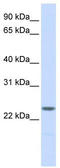 Nucleoplasmin-2 antibody, TA344382, Origene, Western Blot image 