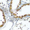 WW Domain Containing Transcription Regulator 1 antibody, A8202, ABclonal Technology, Immunohistochemistry paraffin image 