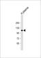 Inter-Alpha-Trypsin Inhibitor Heavy Chain 4 antibody, 61-297, ProSci, Western Blot image 