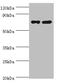 Poly(A)-Specific Ribonuclease antibody, A53761-100, Epigentek, Western Blot image 