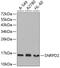 Small Nuclear Ribonucleoprotein D2 Polypeptide antibody, 19-285, ProSci, Western Blot image 