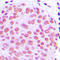 Jun Proto-Oncogene, AP-1 Transcription Factor Subunit antibody, LS-C352431, Lifespan Biosciences, Immunohistochemistry paraffin image 