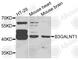 Beta-1,3-N-Acetylgalactosaminyltransferase 1 (Globoside Blood Group) antibody, A7755, ABclonal Technology, Western Blot image 