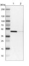 Alpha-2-macroglobulin receptor-associated protein antibody, NBP1-89334, Novus Biologicals, Western Blot image 