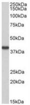 Hydroxyacid Oxidase 2 antibody, NBP2-47139, Novus Biologicals, Western Blot image 
