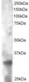 Tetraspanin 32 antibody, LS-C55272, Lifespan Biosciences, Western Blot image 