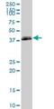 HLA class I histocompatibility antigen, B-82 alpha chain antibody, H00003106-B01P, Novus Biologicals, Western Blot image 