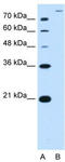 Solute Carrier Family 26 Member 5 antibody, TA334633, Origene, Western Blot image 